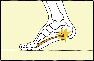 よくあるその足裏の痛みの正体は 足のお悩み百科