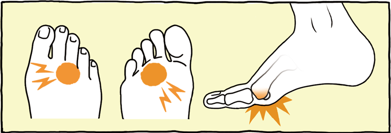 親指 痛い の の 足 裏 安全靴に親指が当たって痛い！安全靴が足に合っていないかも！？