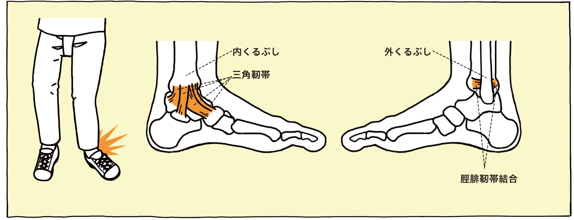 足首が痛い 原因 と 場所 から分類 解説 対処法 足のお悩み百科